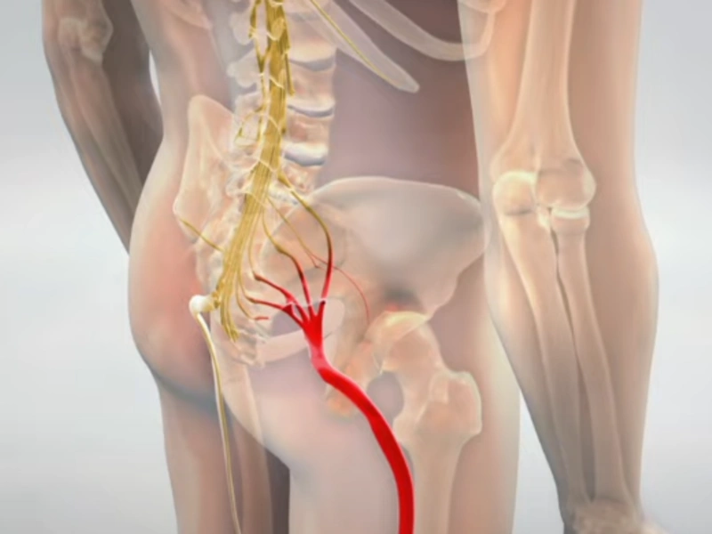 osteopathe rabat sciatique